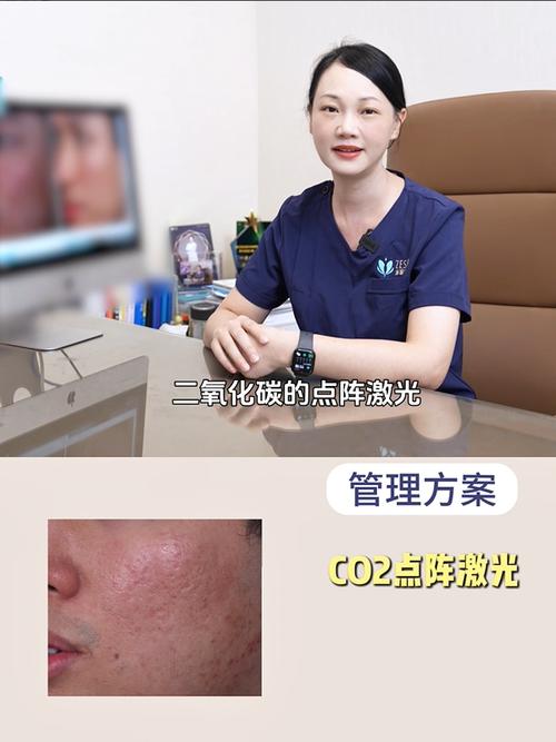 玻尿酸祛痘坑真的有效吗?-图1 玻尿酸祛痘坑真的有效吗?-图1