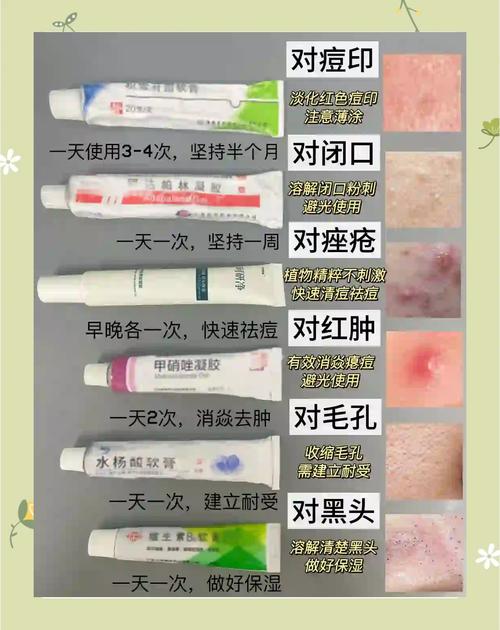 祛痘产品涂了要洗掉吗？-图3