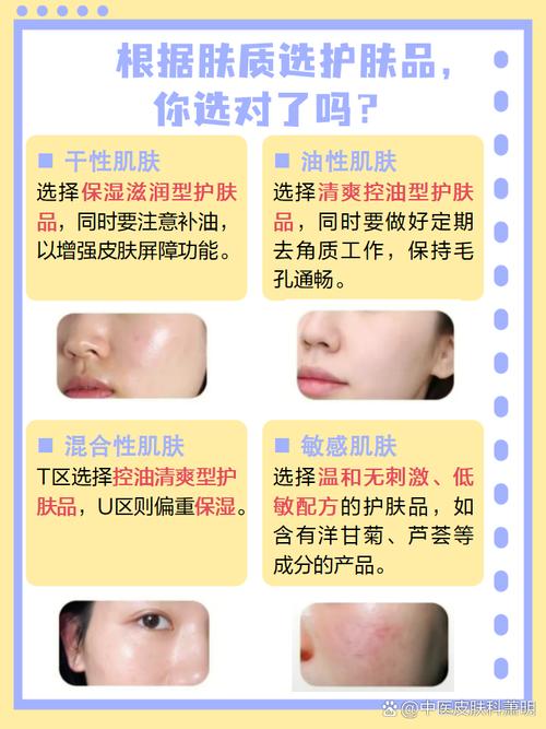 脸易过敏，护肤品怎么选？-图3