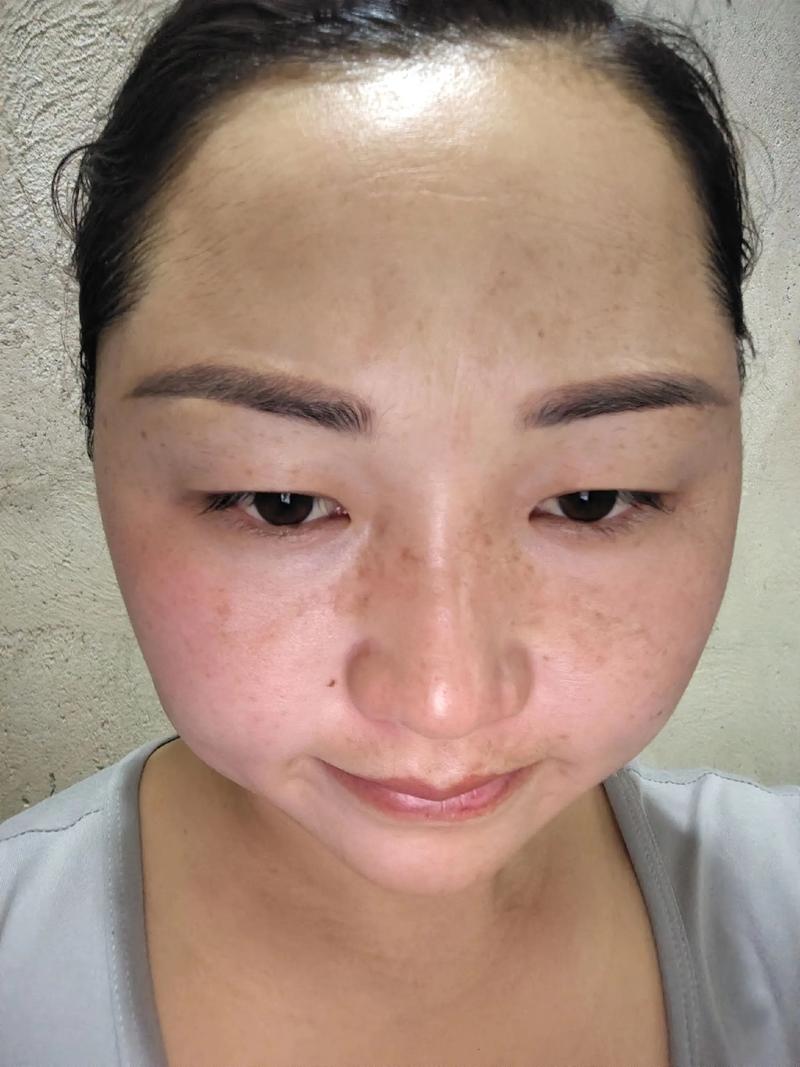 哺乳期用美白护肤品安全吗？-图2