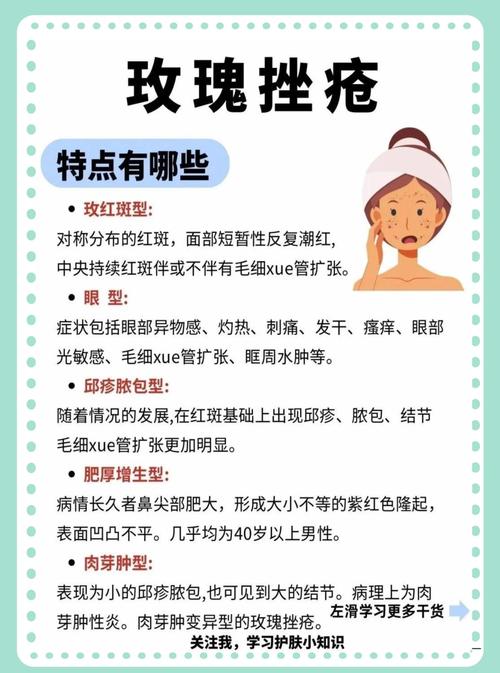 玫瑰蔻真的能祛痘吗？-图2