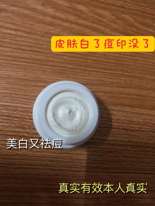 中草药祛痘产品哪些更有效？-图1