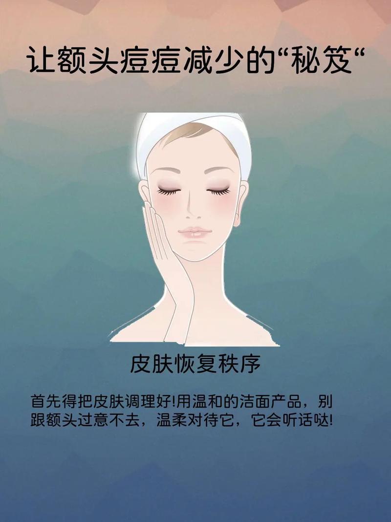 男士额头祛痘小窍门有哪些？-图3