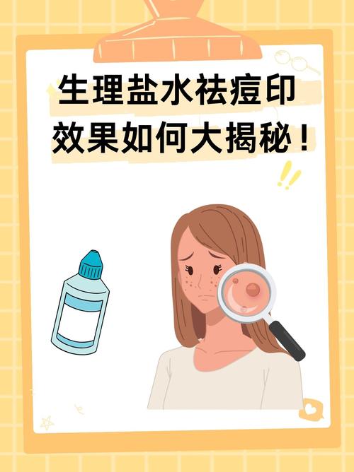 盐水祛痘印真的快速有效吗？-图3