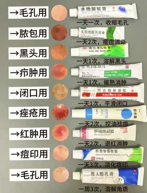 见效快的祛痘膏,是否暗藏风险?-图3 见效快的祛痘膏,是否暗藏风险?-图3
