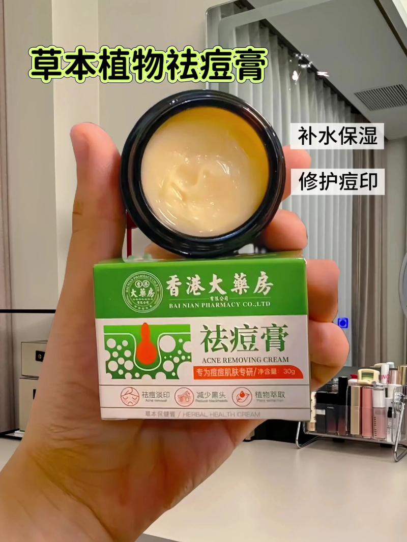 香港祛痘药膏有哪些？推荐哪种？-图1