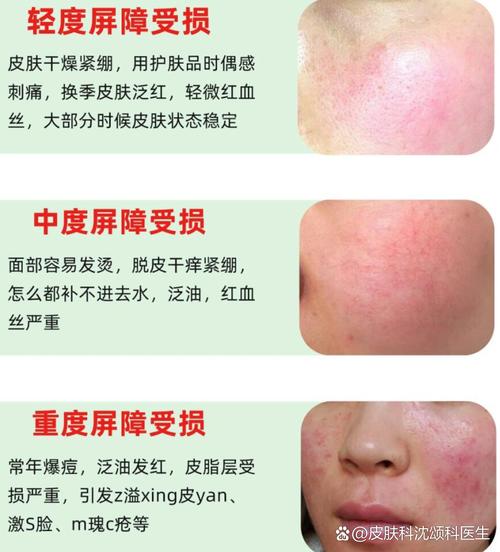 皮肤过敏后，护肤品还能用吗？-图2