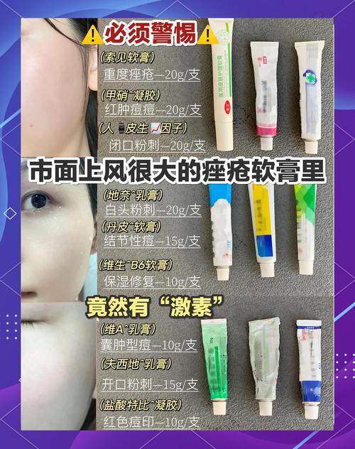 祛痘性价比高的好用的有哪些？-图2