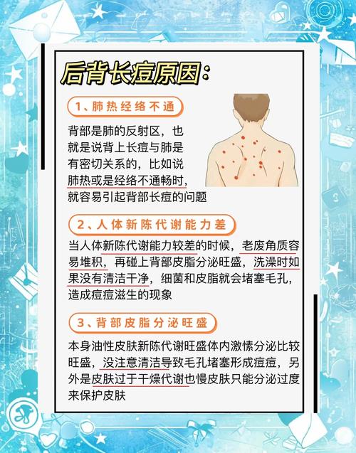 祛痘方法有哪些？健康有效的有哪些？-图3