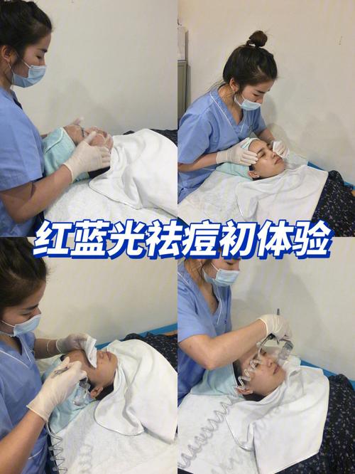 红蓝光祛痘能天天照吗？-图3