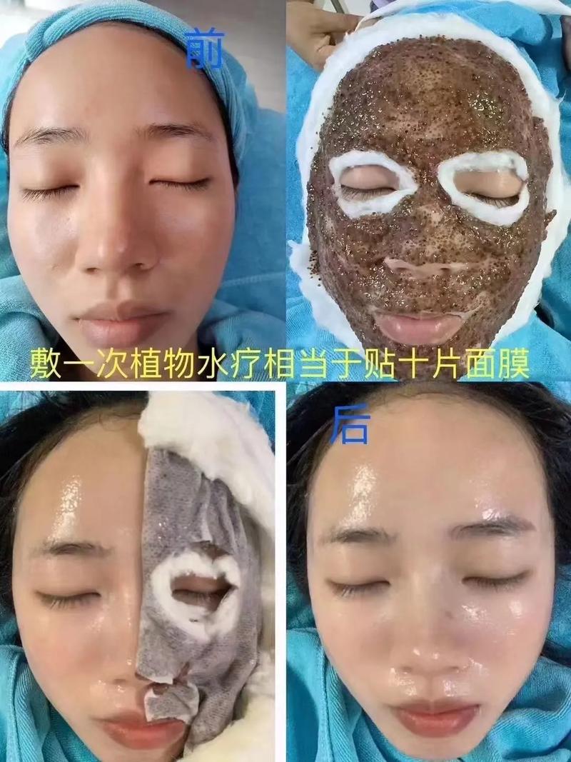 海藻泥搭配什么能祛痘最有效？-图3