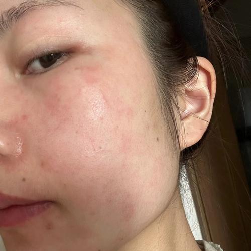 花印祛痘面膜怎么辨真假？-图1