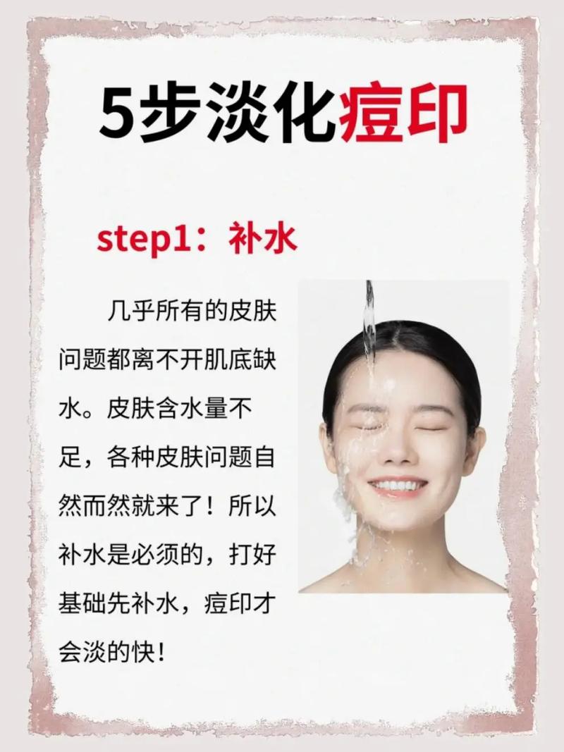 蜂蜜摸脸上可以祛痘吗-图3 蜂蜜摸脸上可以祛痘吗-图3