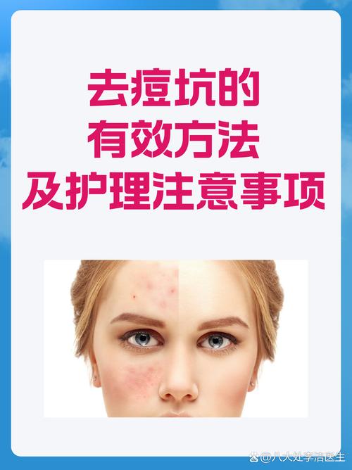 不用激光祛痘能治好吗-图3