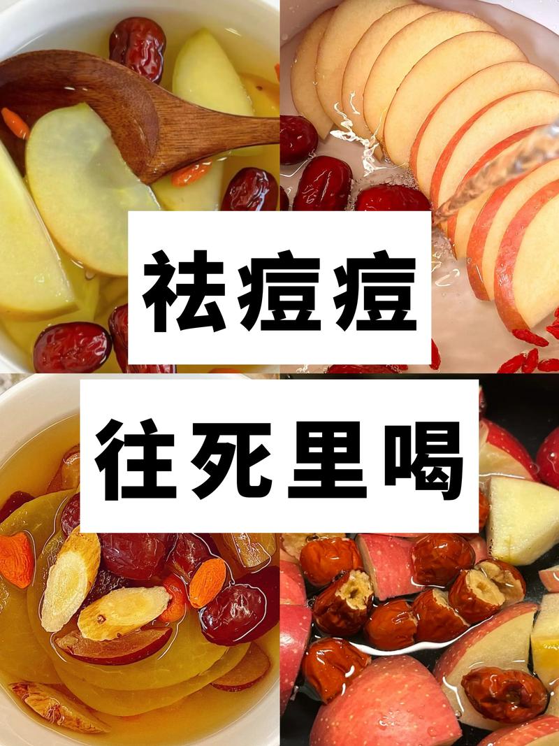 苹果祛痘印每天敷几次合适？-图3