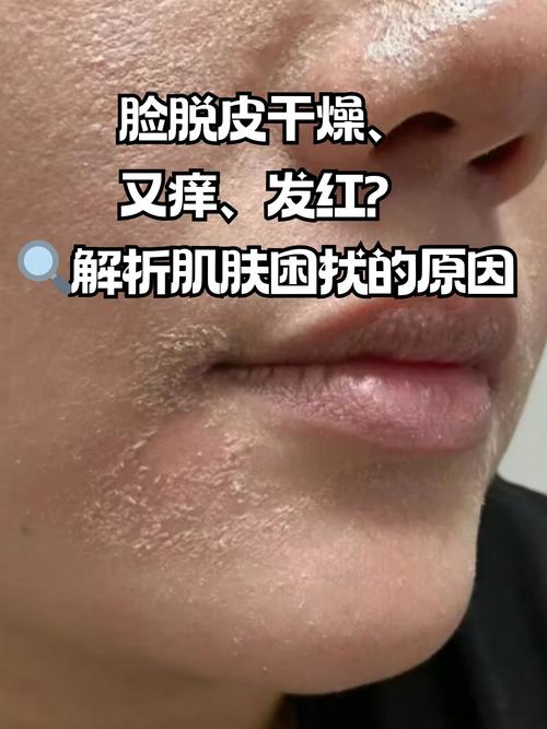 用了护肤品脸又红又痒-图2