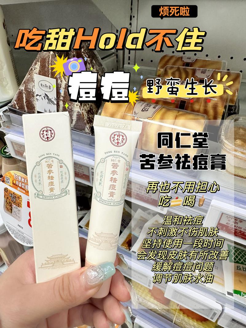 中药祛痘的都有哪些药-图3