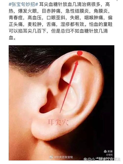 耳朵上放血祛痘的原理-图2