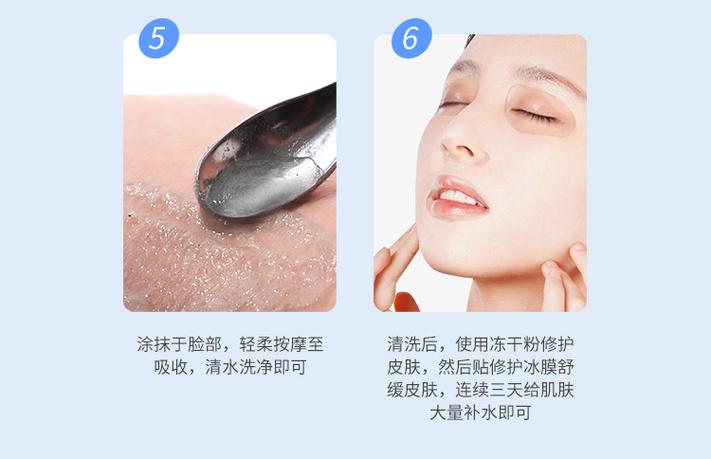 修复冰晶真能祛痘印吗？-图3