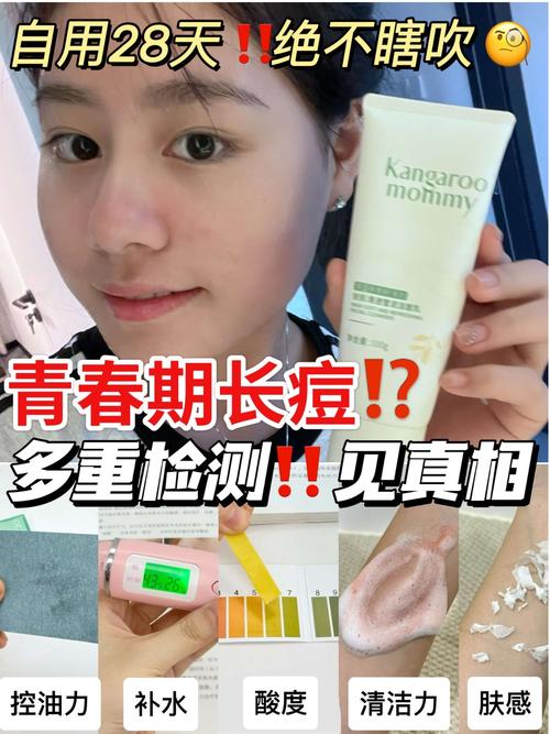 知道祛痘产品里有激素-图3