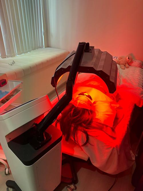 韩国祛痘机器真能快速祛痘吗？-图1