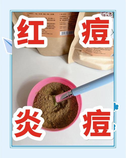 自制中药祛痘面膜真的有效吗？-图2