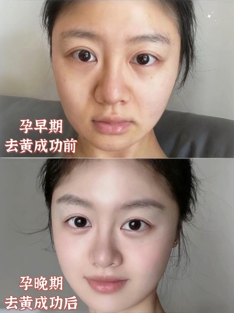 孕妇能不能用面膜护肤-图1