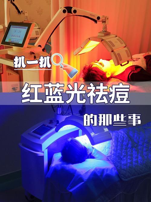 做蓝光可以祛痘成功吗-图1