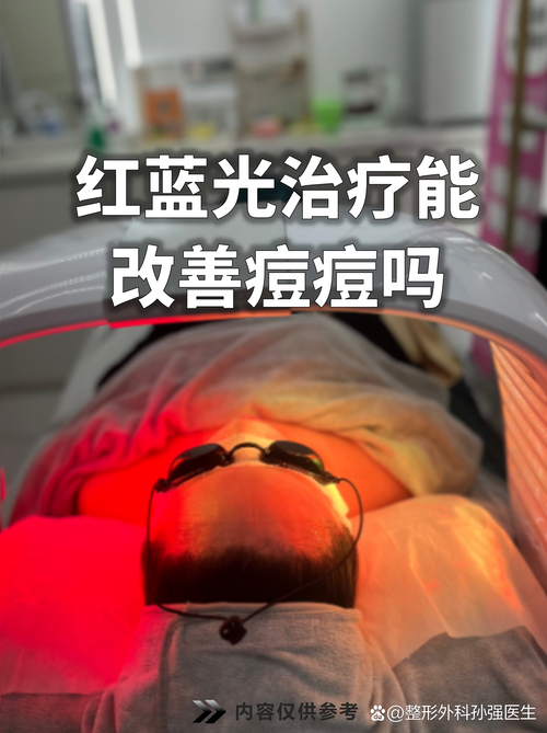 做蓝光可以祛痘成功吗-图3
