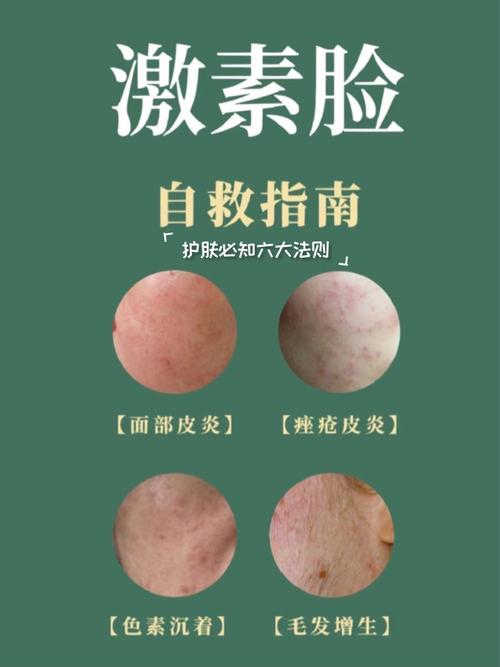 怎么知道护肤品有激素-图3