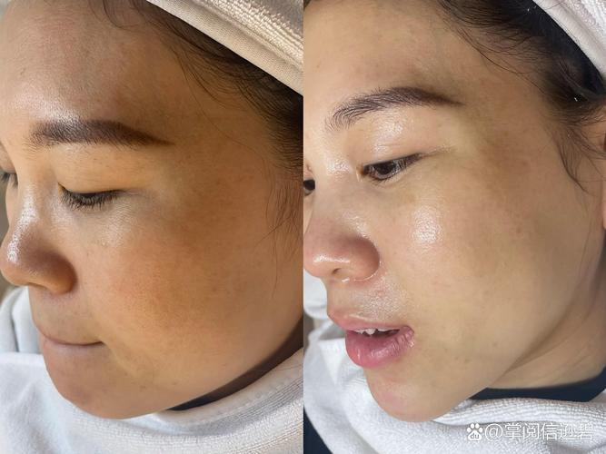 混合性偏干皮肤 护肤-图2