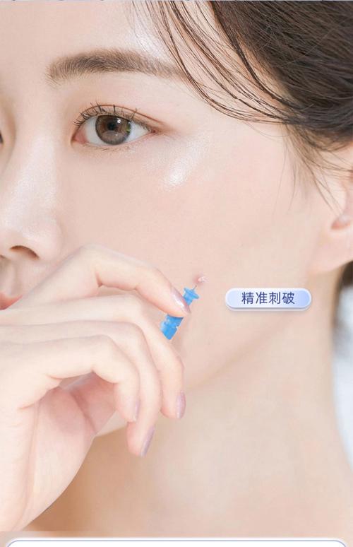 粉刺针消毒就能祛痘？靠谱吗？-图1