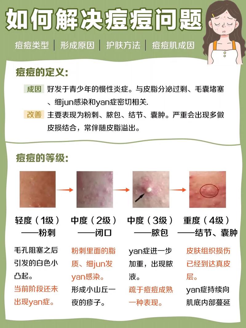 如何祛痘坑是皮肤变好-图2