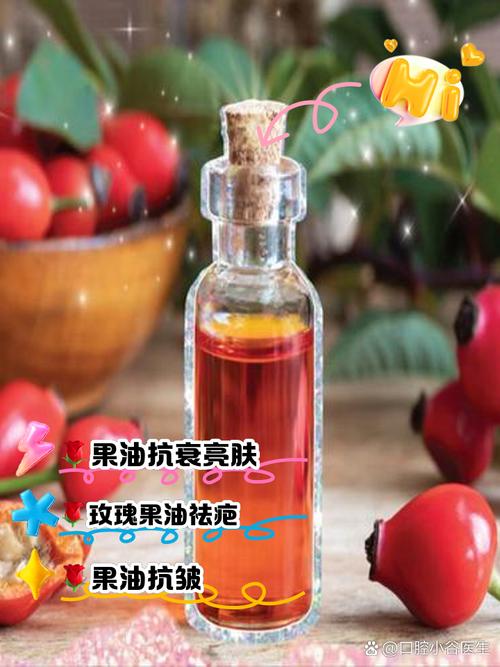 玫瑰果胶囊能祛痘吗？-图2