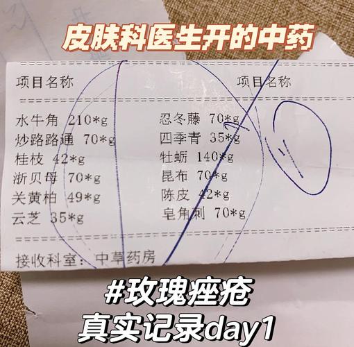 中药泡制祛痘药水配方有何秘诀？-图2