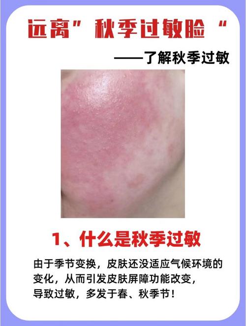 脸过敏了还能用护肤品吗？-图1