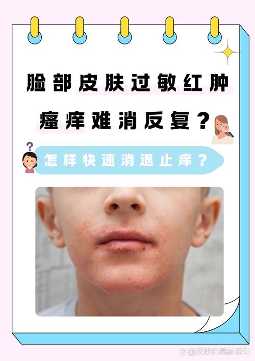 脸过敏了还能用护肤品吗？-图2