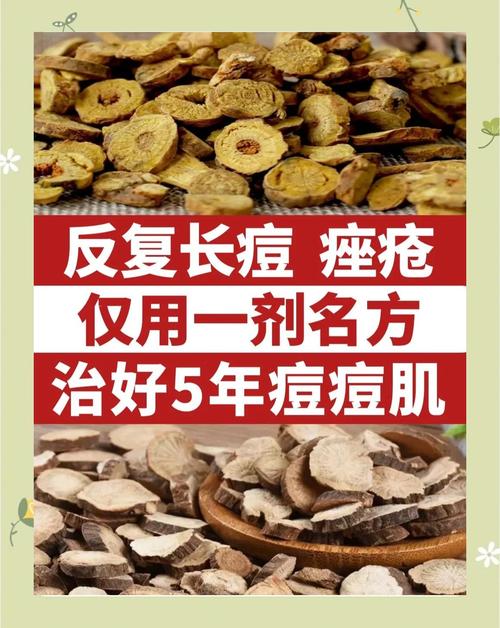 民间中药祛痘偏方大全-图2