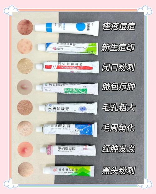 祛痘印的神器都有哪些-图2