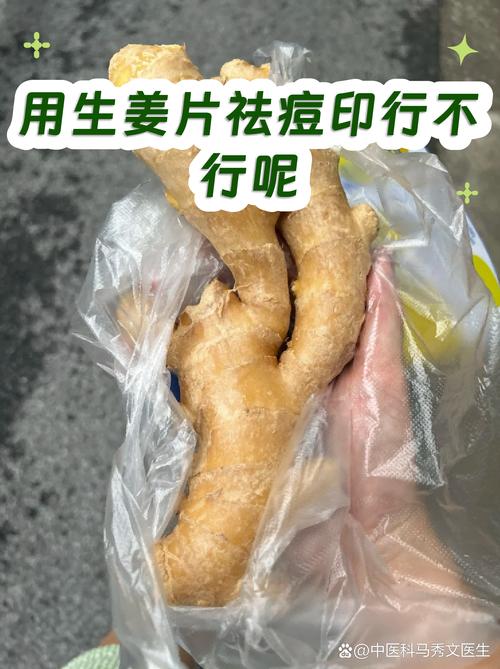 生姜祛痘印每晚能用吗？-图1