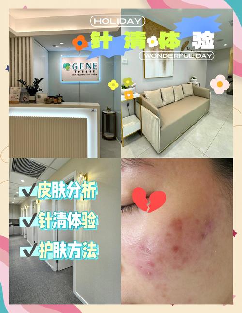 祛痘手术真能清理毛孔吗？-图1