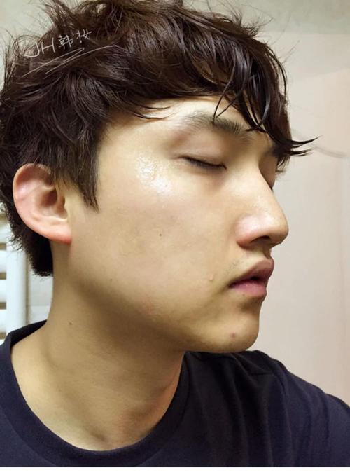 呼吸魔法精华能祛痘印吗？-图1