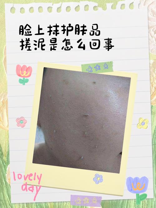 香蕉泥能消炎祛痘吗？-图2