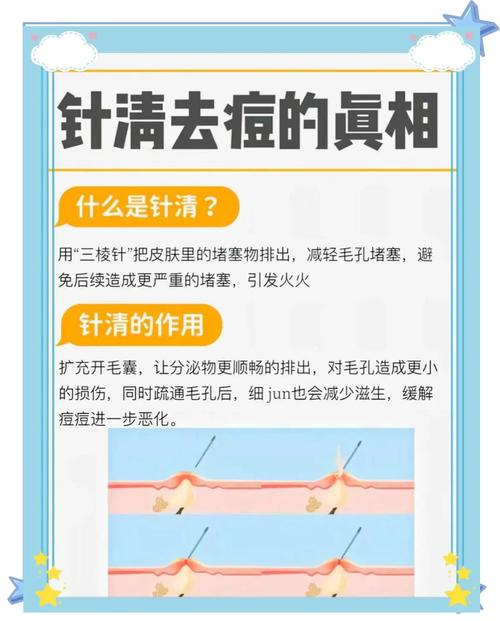 祛痘印先补水还是消炎？-图3