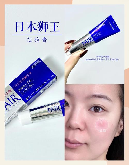 狮王祛痘膏容易过敏么-图1