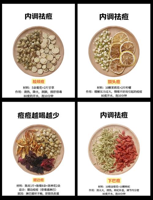 中药祛痘成本高不高？-图1