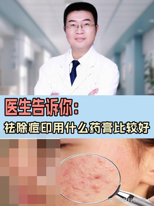 祛痘印疤痕,哪种方法最有效?-图1 祛痘印疤痕,哪种方法最有效?-图1