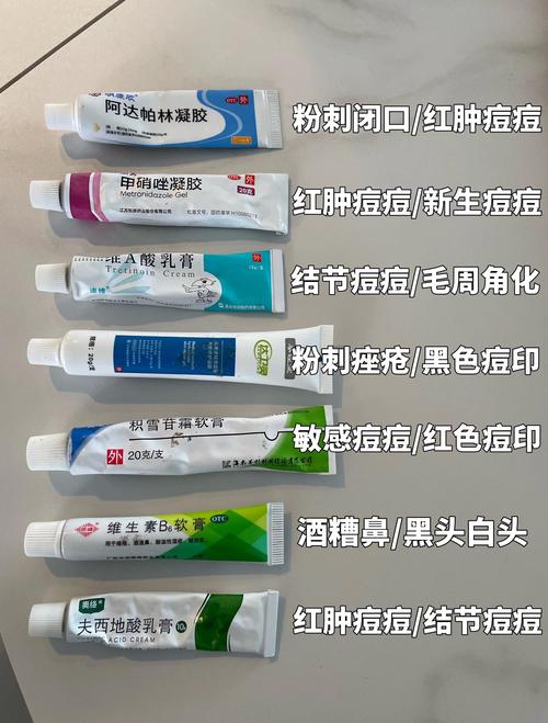 酸奶 维c可以祛痘么-图3 酸奶 维c可以祛痘么-图3