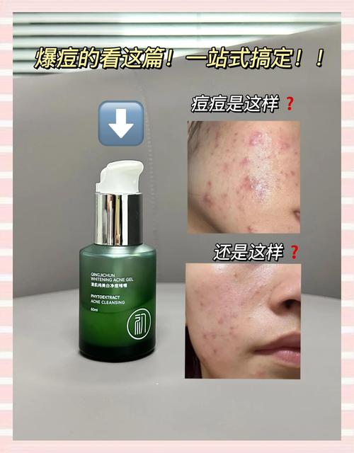 破皮后能用祛痘精油吗?-图1 破皮后能用祛痘精油吗?-图1