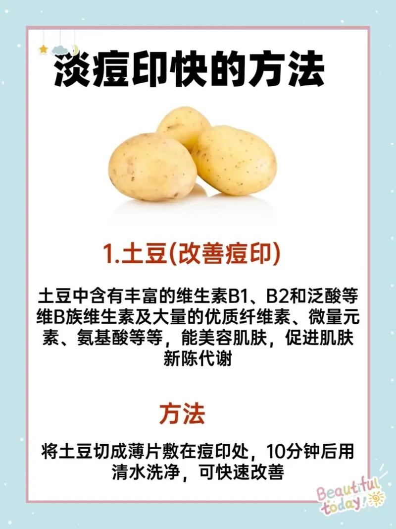 土豆祛痘印的原理是什么?-图1 土豆祛痘印的原理是什么?-图1